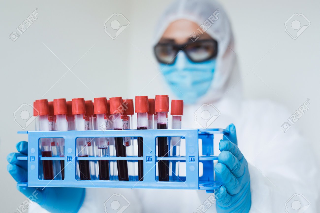 Coronavirus analysis concept. Medical worker holding blood samples rack in the laboratory with test for Covid-19. - 160650303 Coronavirus analysis concept. Medical worker holding blood samples rack in the laboratory with test for Covid-19. - 160650303