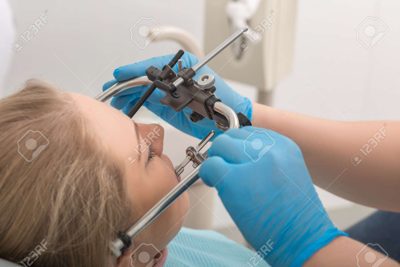 フェイスボウ 咬合器 フェイスボウ 中古品 Yahoo!オークション