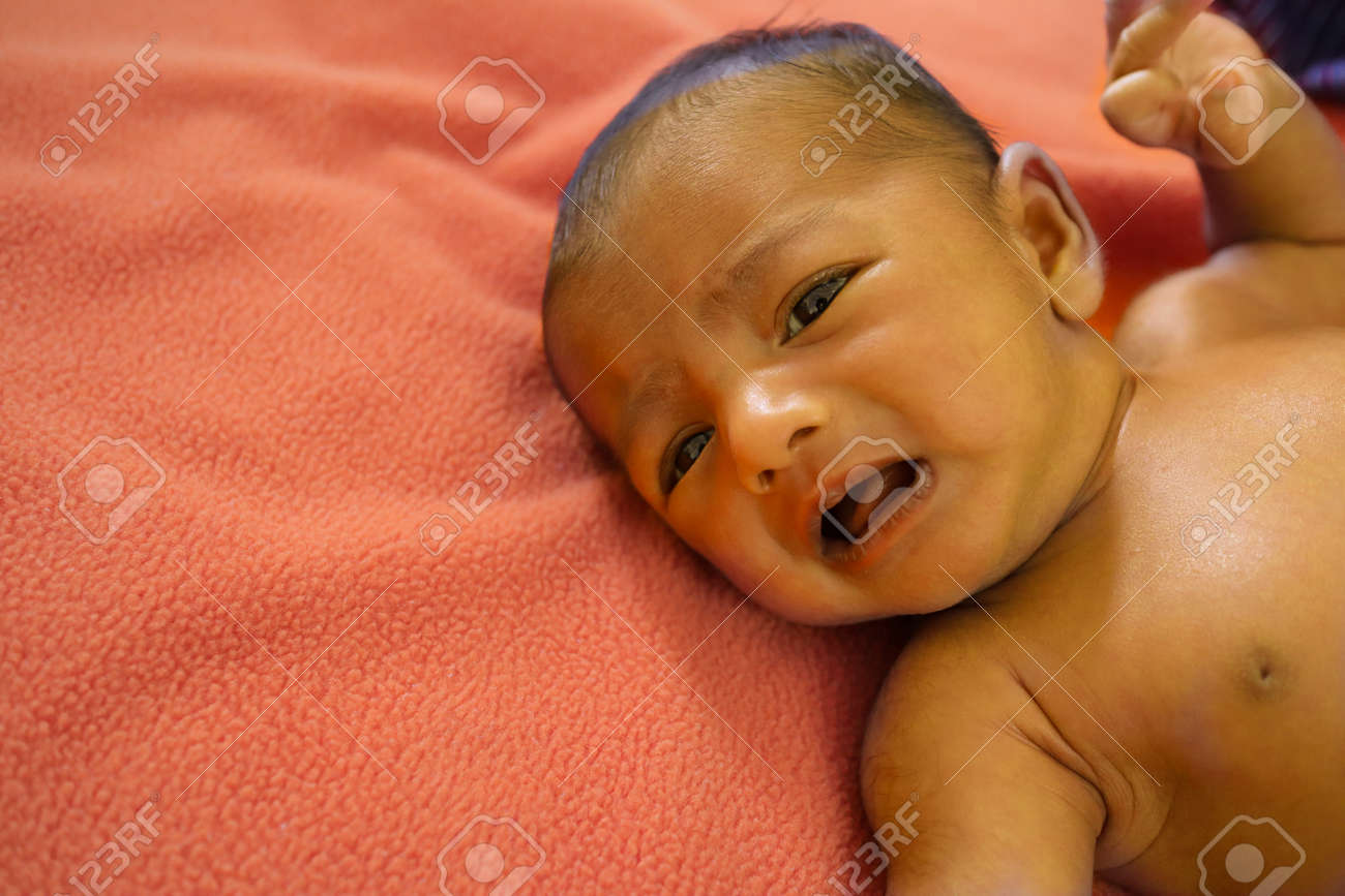 Como Quitar De Bilirrubina Ojos Amarillos En Bebes Causas Puso