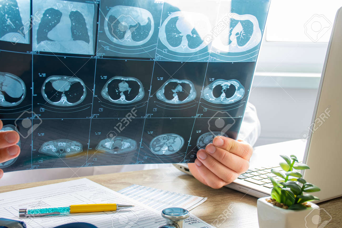 Doctor at appointment inspects and examines ct scan of chest and abdominal cavity. Concept photo on diagnosis of diseases in pulmonology, lung pathology, inflammatory diseases of bronchi, tuberculosis - 138884162 Doctor at appointment inspects and examines ct scan of chest and abdominal cavity. Concept photo on diagnosis of diseases in pulmonology, lung pathology, inflammatory diseases of bronchi, tuberculosis - 138884162