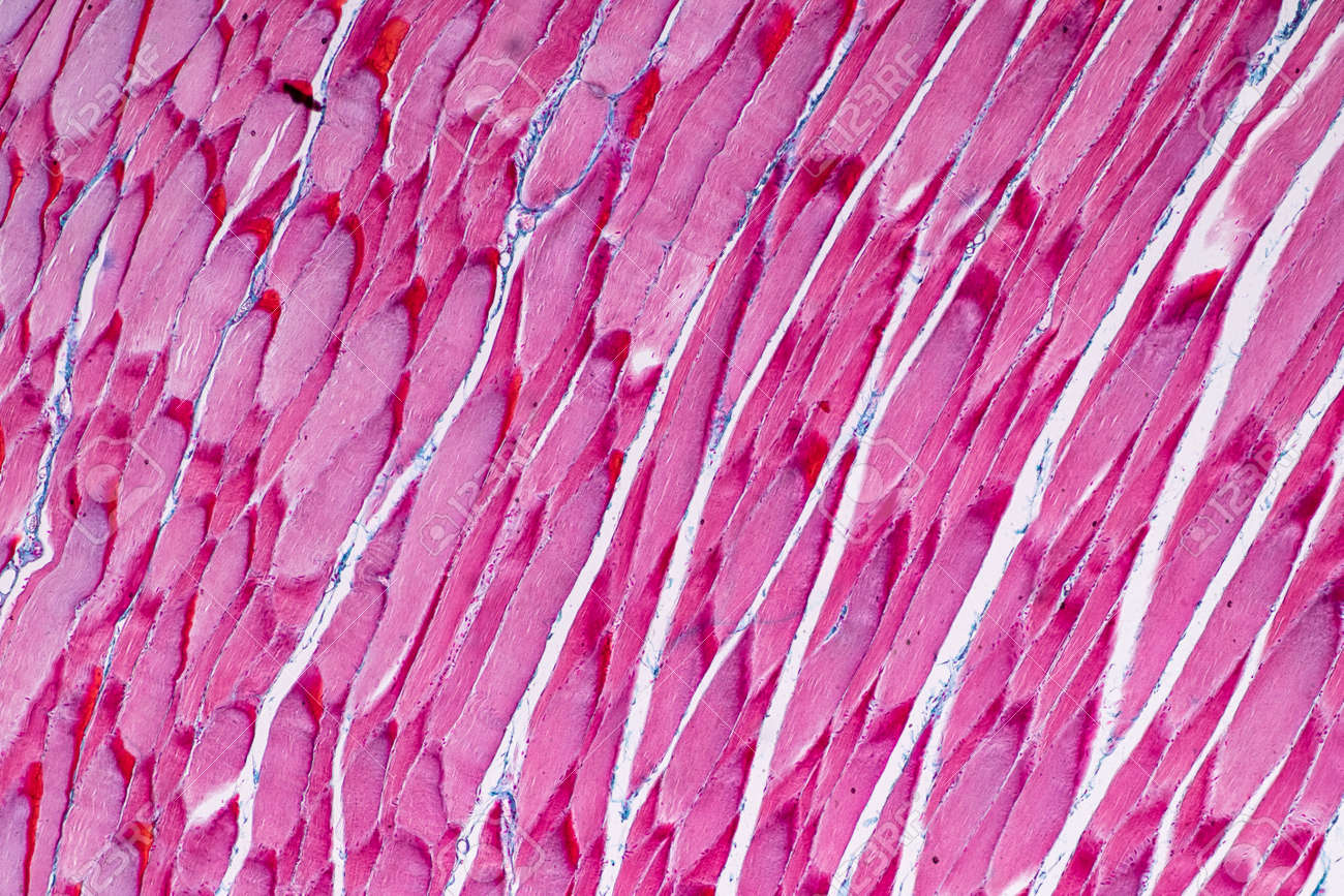 Скелетная мышечная ткань гистология. Пучок мышечных волокон. Волокна скелетных мышц под микроскопом их. Striated skeletal muscle tissue. Волокна скелетных мышц под микроскопом их.