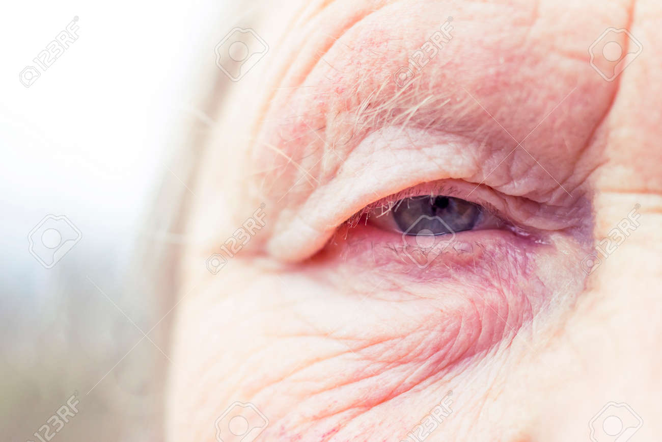 Close-up. Woman aged. Eye in the center of the frame. The pupil has soft focus, the concept of poor eyesight, everything is blurry. - 138706439 Close-up. Woman aged. Eye in the center of the frame. The pupil has soft focus, the concept of poor eyesight, everything is blurry. - 138706439