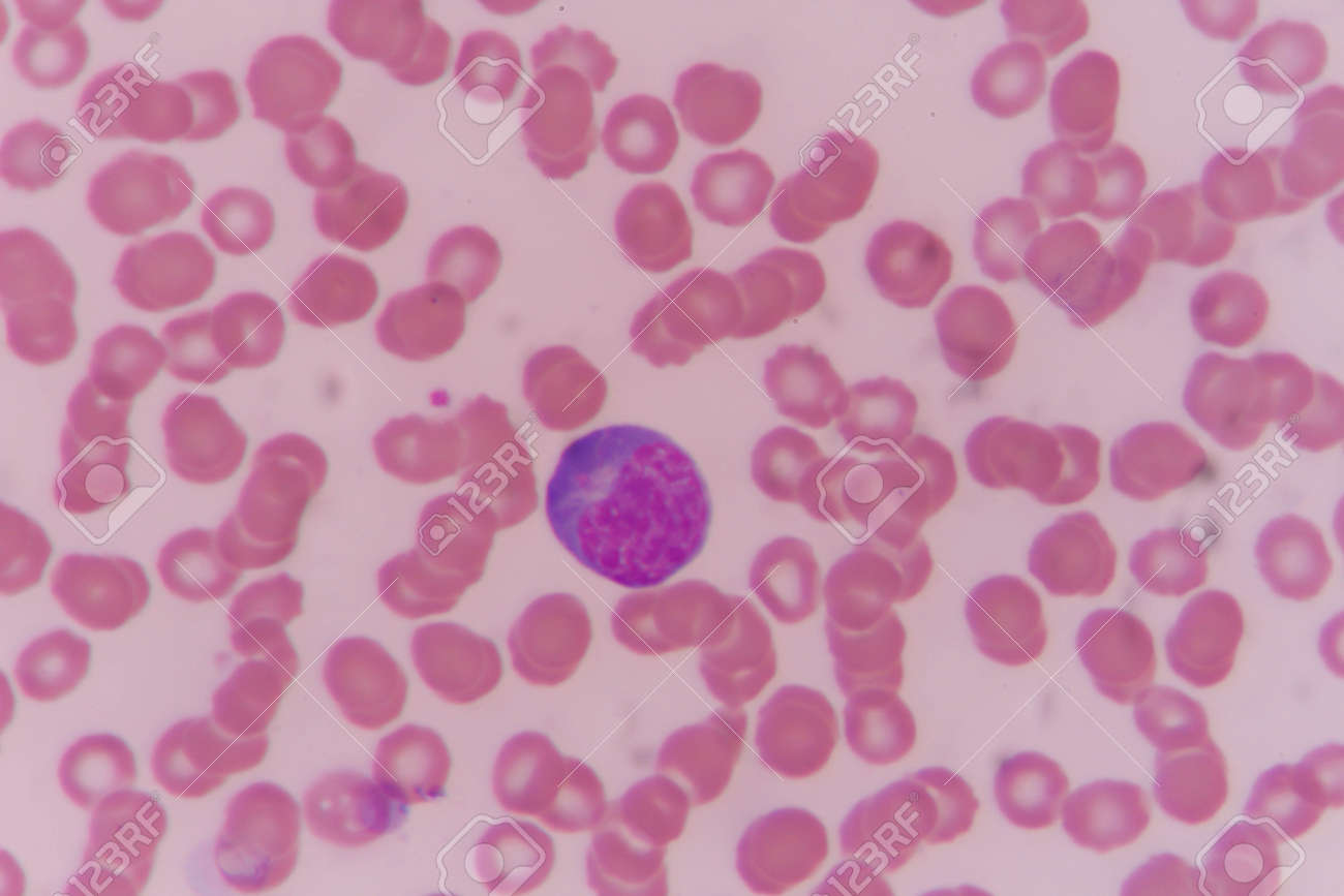 Leucocitos el la en es sangre que