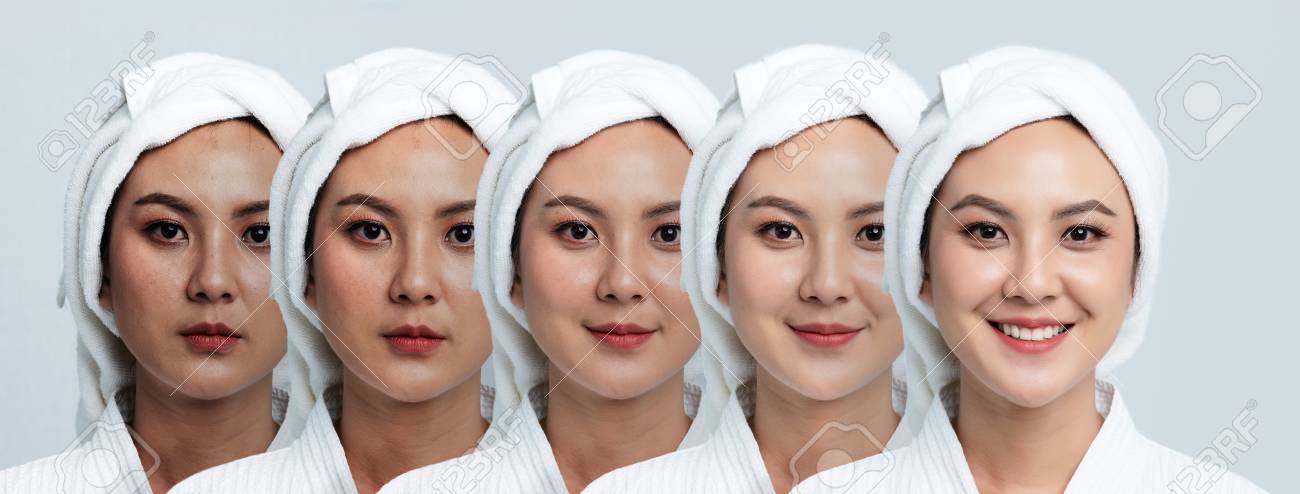 Comparison Portrait of Beautiful Asian woman. Dark spots and new skin, Before - After skin care and clean concept, Beauty treatment process of aging for rejuvenation. - 123736094 Comparison Portrait of Beautiful Asian woman. Dark spots and new skin, Before - After skin care and clean concept, Beauty treatment process of aging for rejuvenation. - 123736094