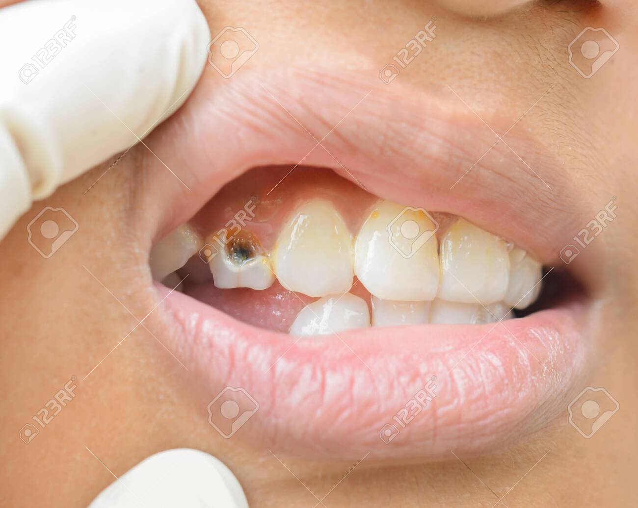 etiam-dictum-ipsum-a-felis