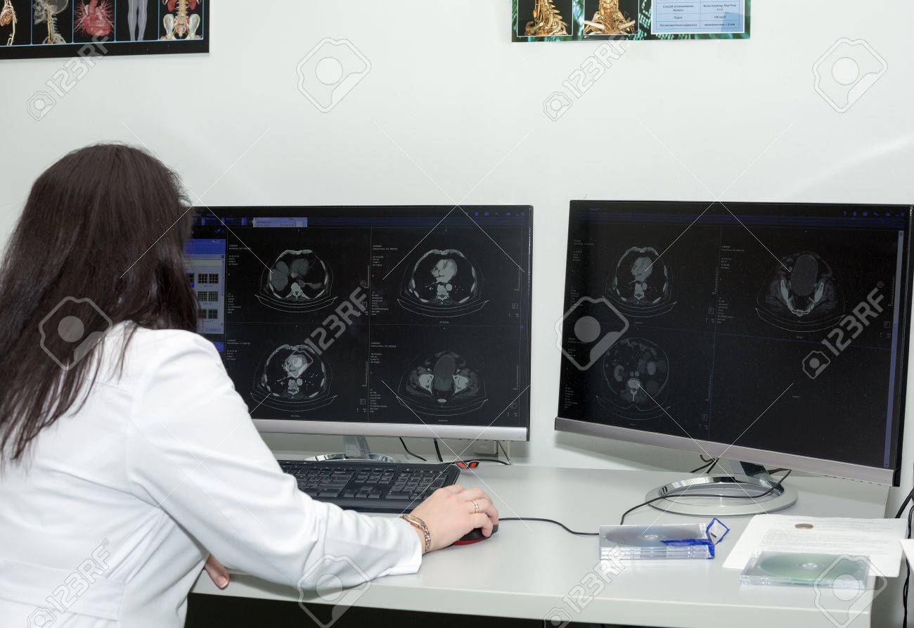 A back view of a brunette female doctor examining CT scanner results - 52593239 A back view of a brunette female doctor examining CT scanner results - 52593239