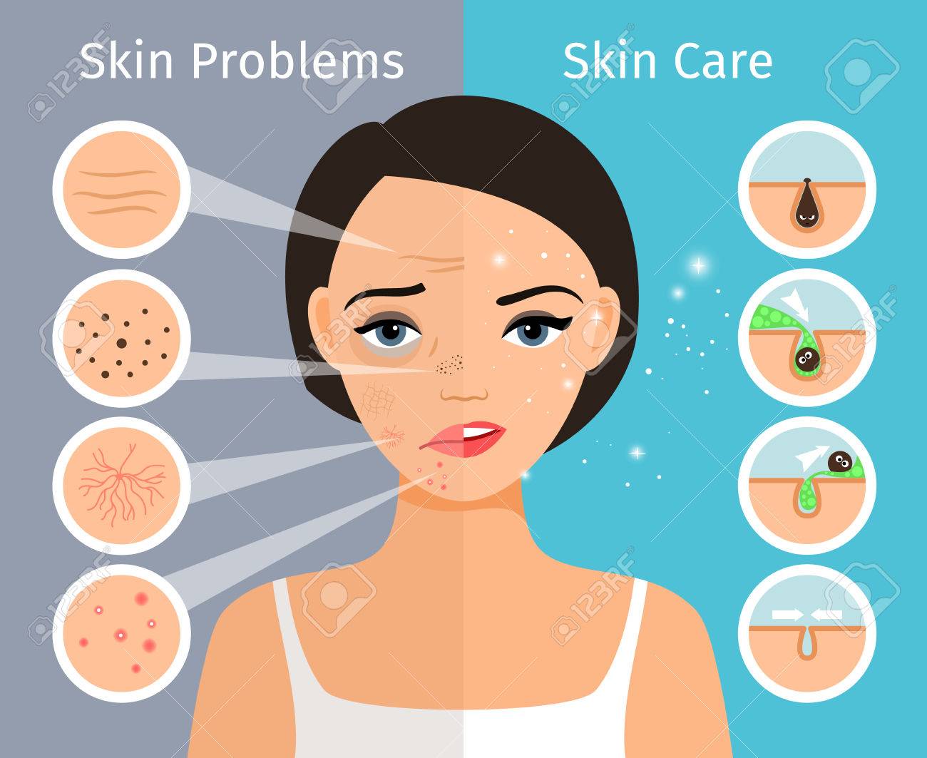Home facial skin clean and oily, care and cosmetology. Female head with beautiful skin problems solution vector illustration - 76594384 Home facial skin clean and oily, care and cosmetology. Female head with beautiful skin problems solution vector illustration - 76594384