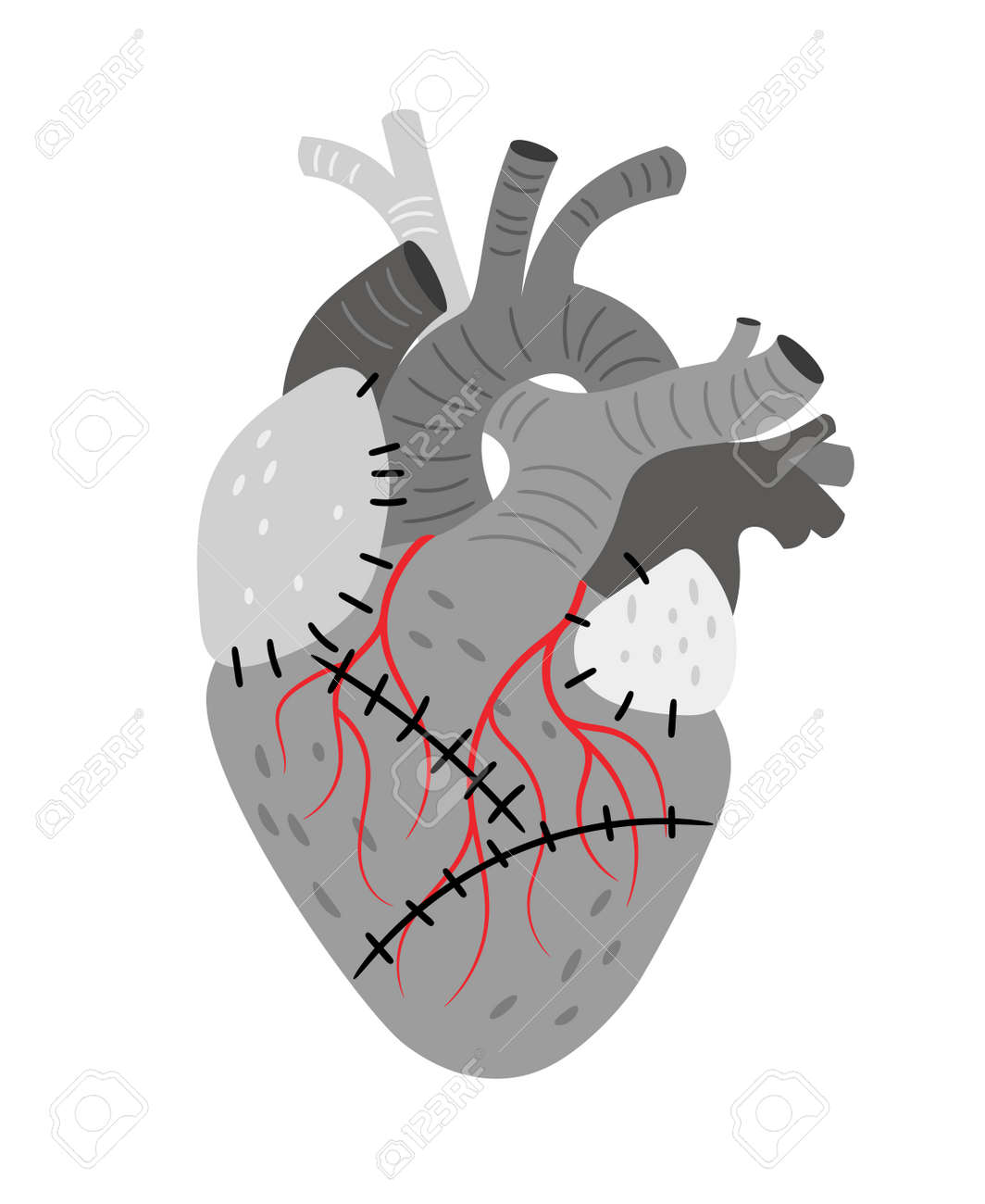 Anatomical organ, heart with stitches - 170995408 Anatomical organ, heart with stitches - 170995408