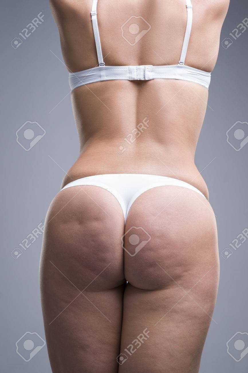 Fat Cellulite Butts Fat Cellulite Butts