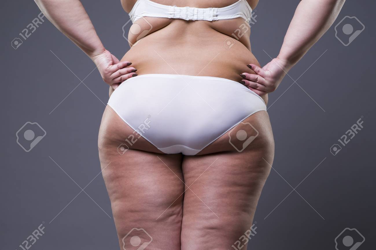 太った脚とお尻を持つ女性灰色の背景に肥満女性の身体を太りすぎ の写真素材 画像素材 Image