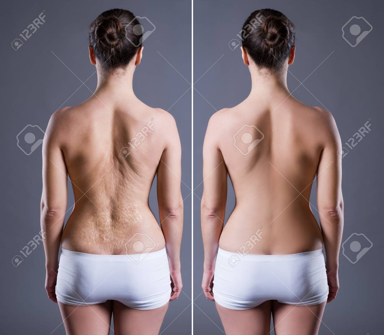 10390 Thick Legs Images, Stock Photos & Vectors
