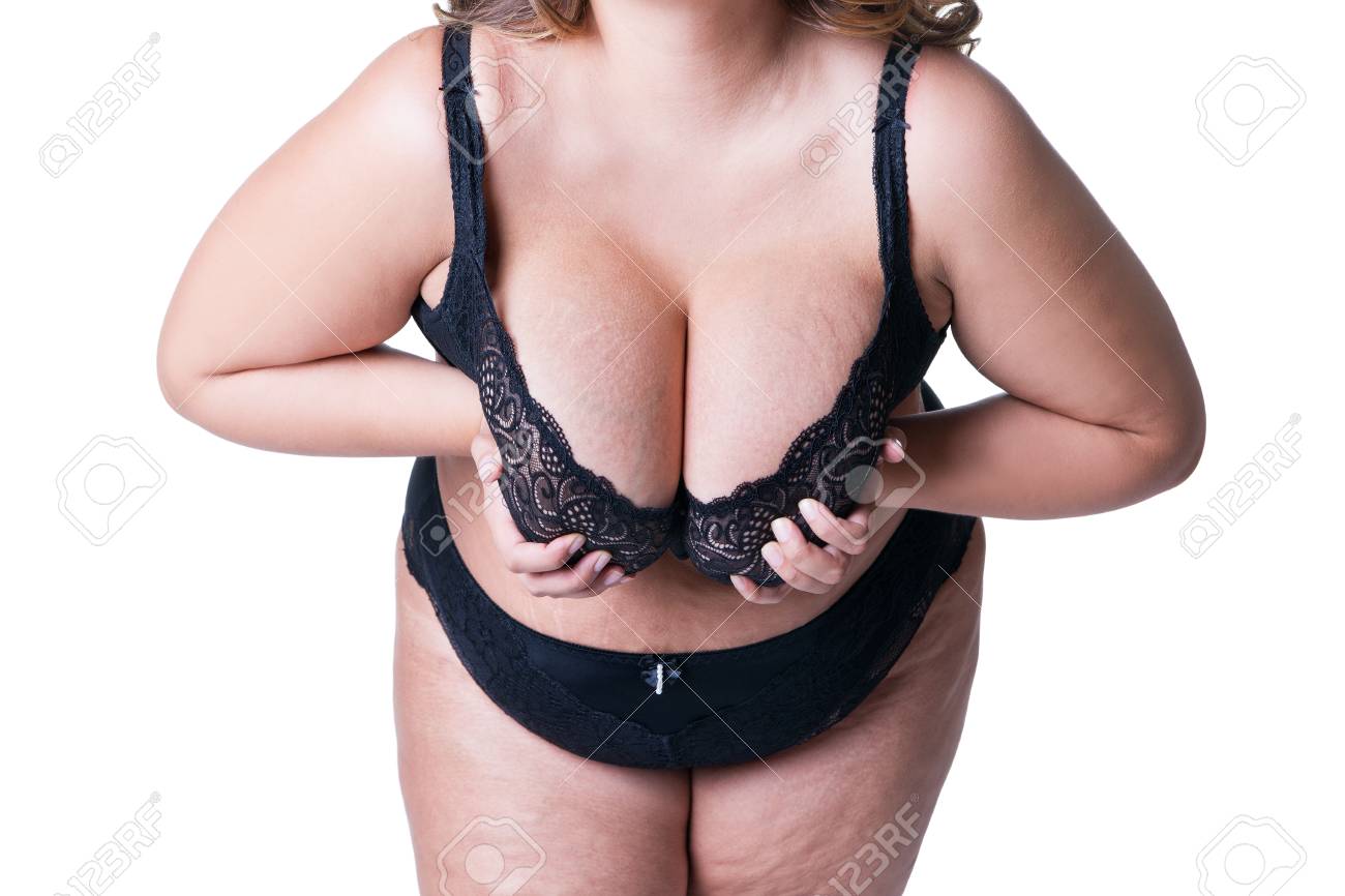 Dehnungsstreifen Auf Einer Großen Natürlichen Brüste, Fettleibige Frau Mit  Großen Titten, Übergewichtiger Weiblicher Körper Lokalisiert Auf Weißem  Hintergrund Lizenzfreie Fotos, Bilder und Stock Fotografie. Image 104871915.