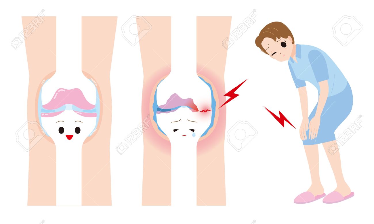 女性の関節痛 のイラスト素材 ベクタ Image