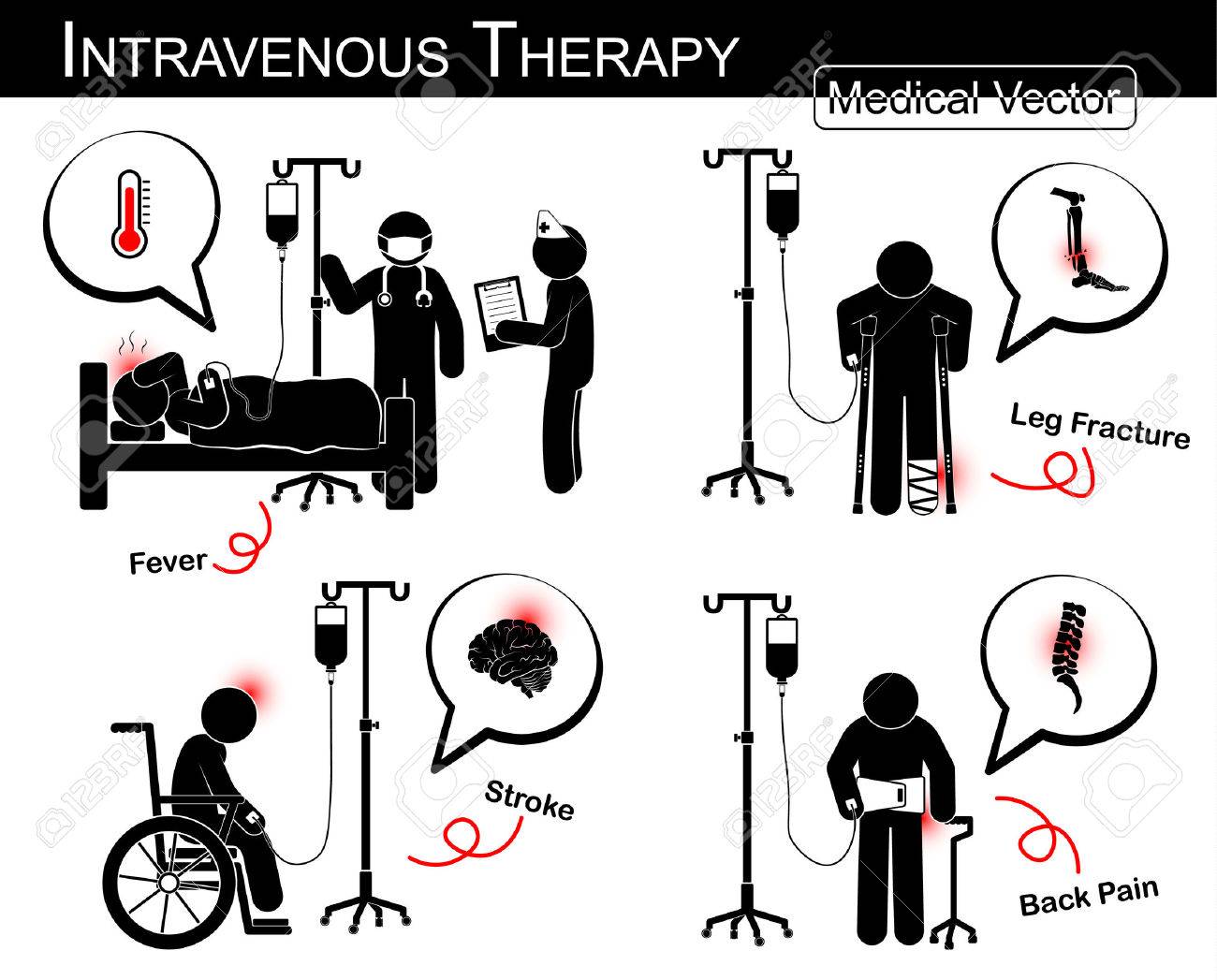 Set of vector stick man : patient with multiple disease with intravenous fluid ( flat design , Black white style )( Medical and Science concept )( Fever , Leg fracture , Stroke attack , Low back pain) - 42537791 Set of vector stick man : patient with multiple disease with intravenous fluid ( flat design , Black white style )( Medical and Science concept )( Fever , Leg fracture , Stroke attack , Low back pain) - 42537791