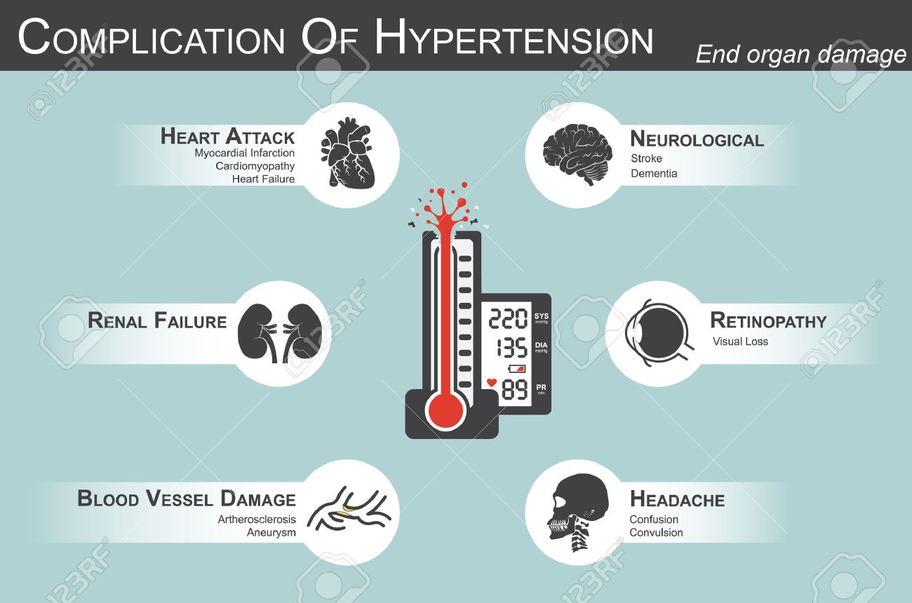 Complicaciones de la submentoplastia de la hipertensión Complicaciones de la submentoplastia de la hipertensión
