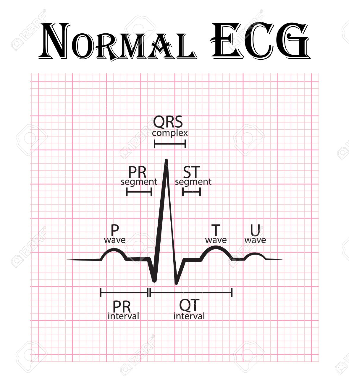 normal ecg electrocardiogram p wave pr segment pr interval p wave ecg