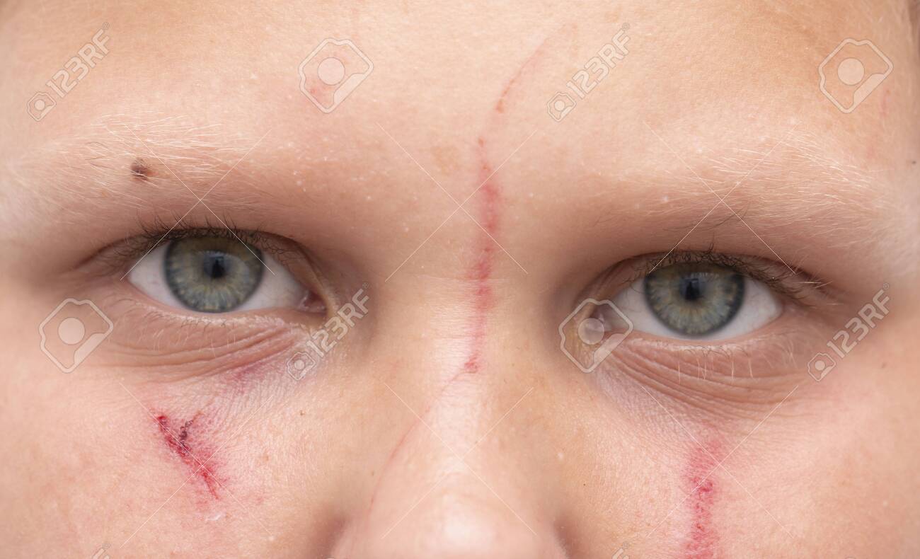 Red Scratches On The Face As A Background Stock Photo, Picture and Royalty  Free Image. Image 154097401.
