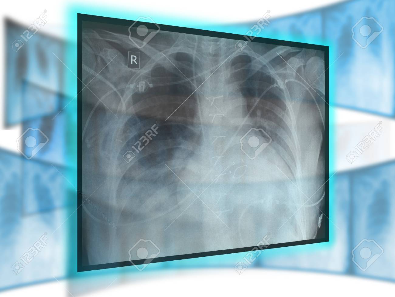 etiam-dictum-ipsum-a-felis