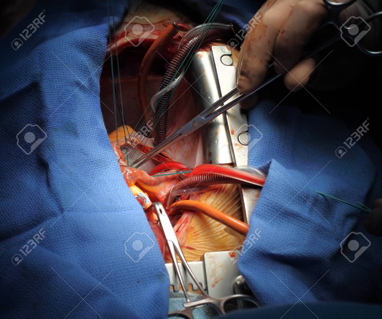 etiam-dictum-ipsum-a-felis