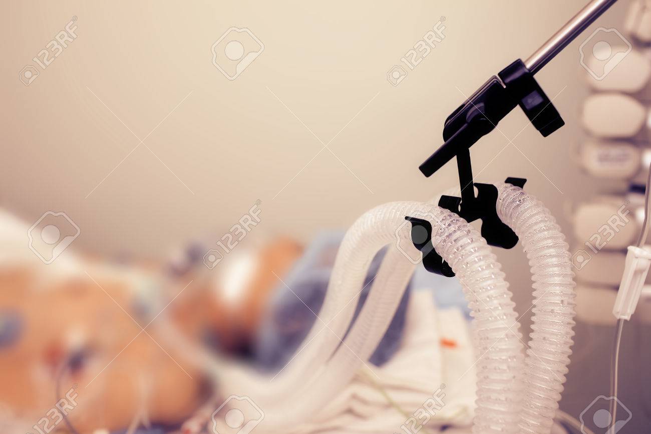 Patient on the artificial lung ventilation in ICU - 55908538 Patient on the artificial lung ventilation in ICU - 55908538