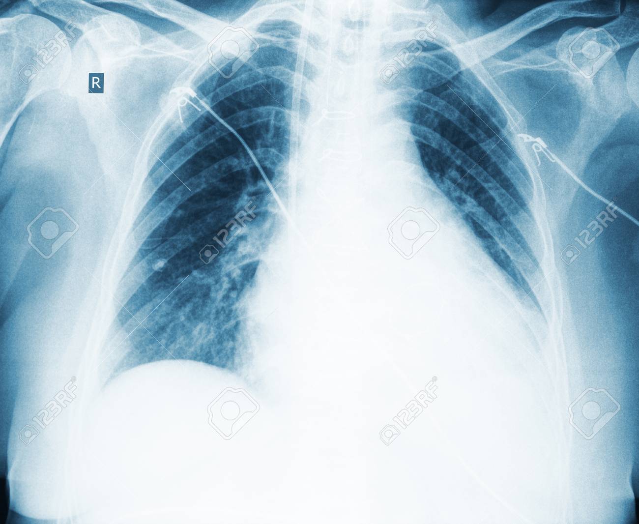 etiam-dictum-ipsum-a-felis