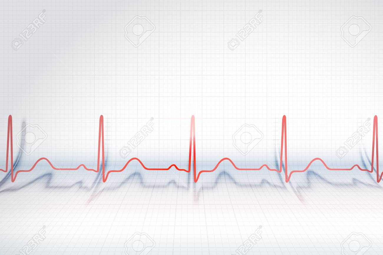 red line of ecg chart on the background of bended plotting paper
