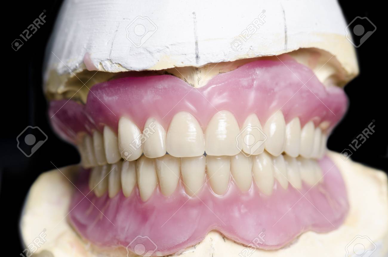 Insertable teeth: peculiarities of dental prosthetics Insertable teeth: peculiarities of dental prosthetics