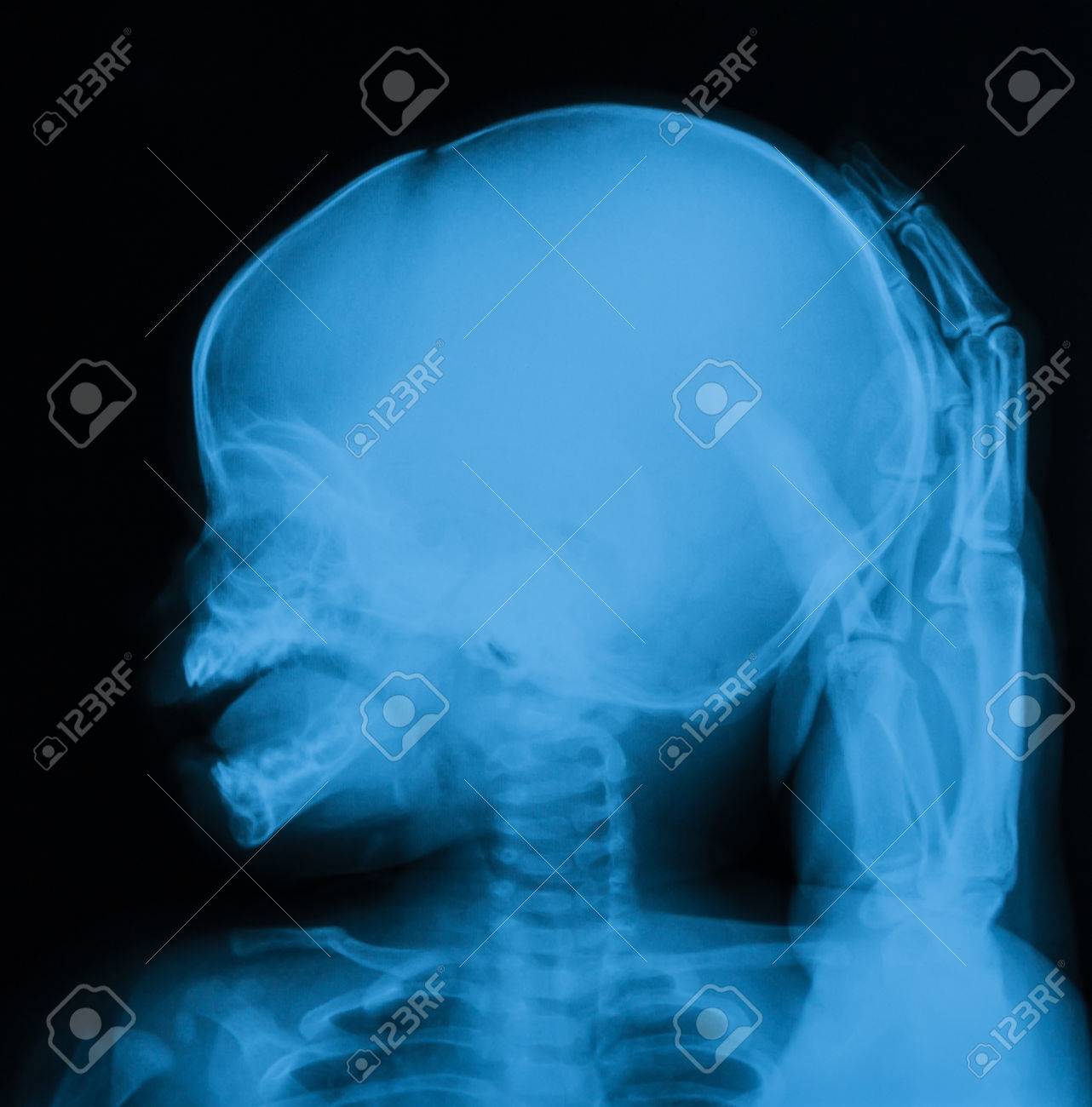 Radiographie Du Crane Image De Bebe Avec La Main De Pere Banque D Images Et Photos Libres De Droits Image