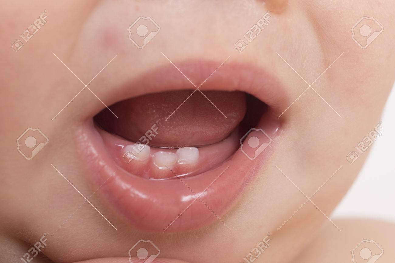 milk tooth baby