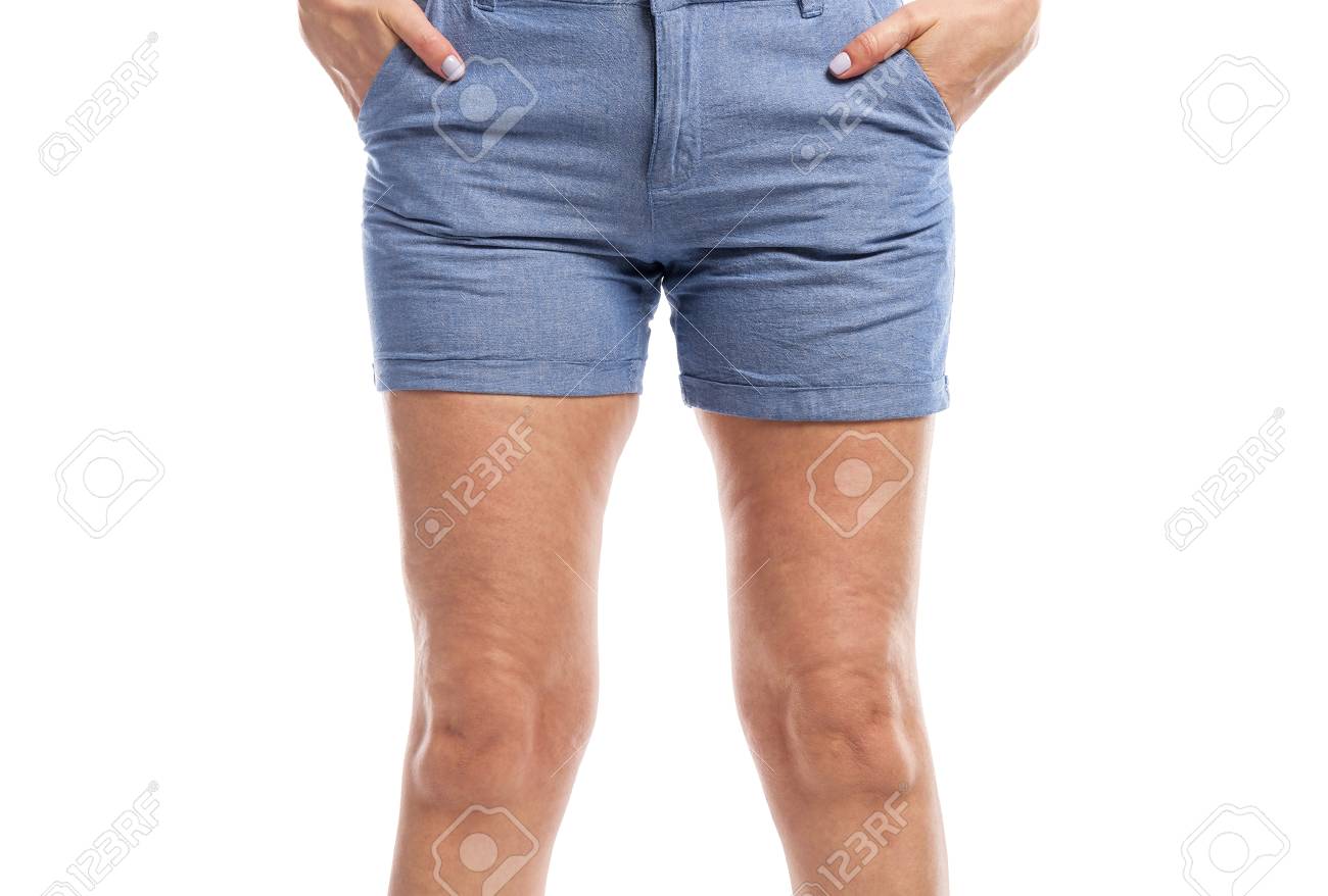 足の脂肪とセルライト の写真素材 画像素材 Image