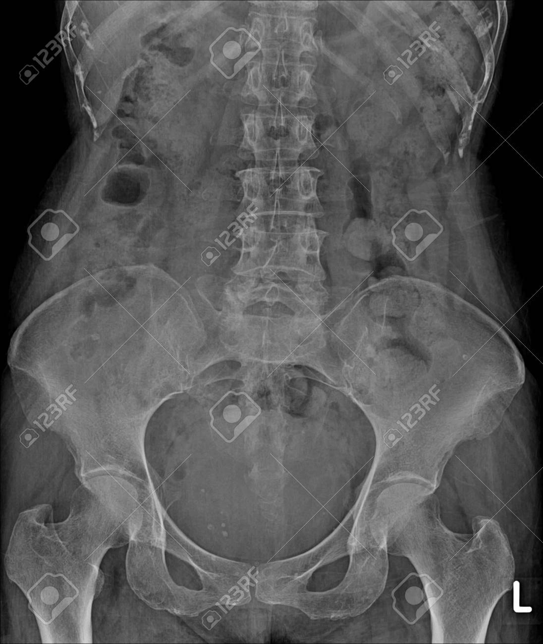 etiam-dictum-ipsum-a-felis