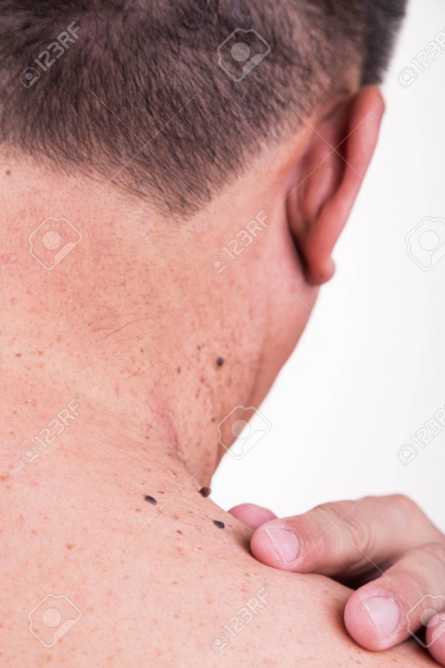 Mature asian women spanked Asian moles for photography