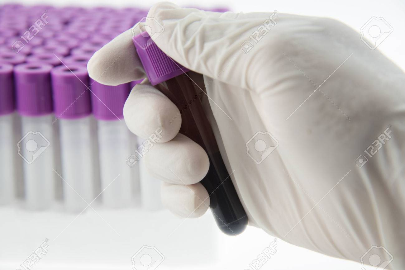 Edta Blood Tube For Cbc Test In Laboratory Stock Photo Picture And Royalty Free Image Image