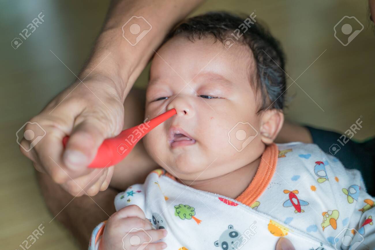 infant has runny nose
