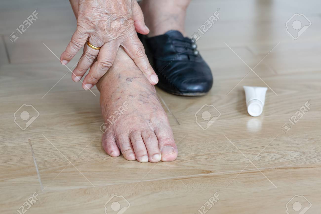 Elderly Woman Putting Cream On Swollen Feet Before Put On Shoes