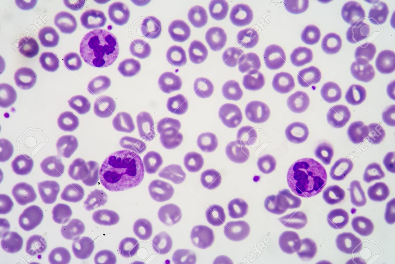 Que es el leucocitos en la sangre