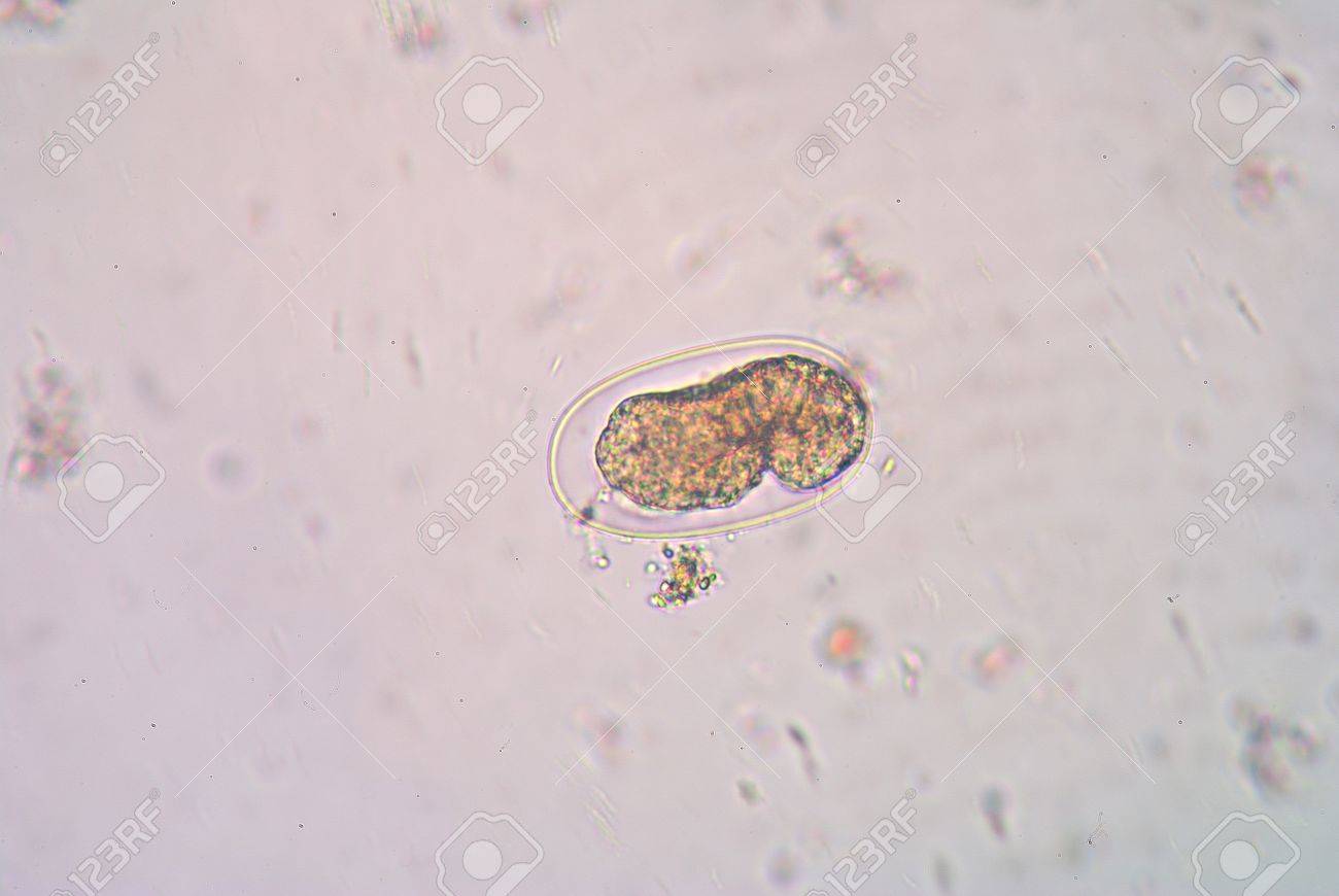鉤虫は、犬、猫、人間などの哺乳類は、そのホストの小腸に住んでいる 