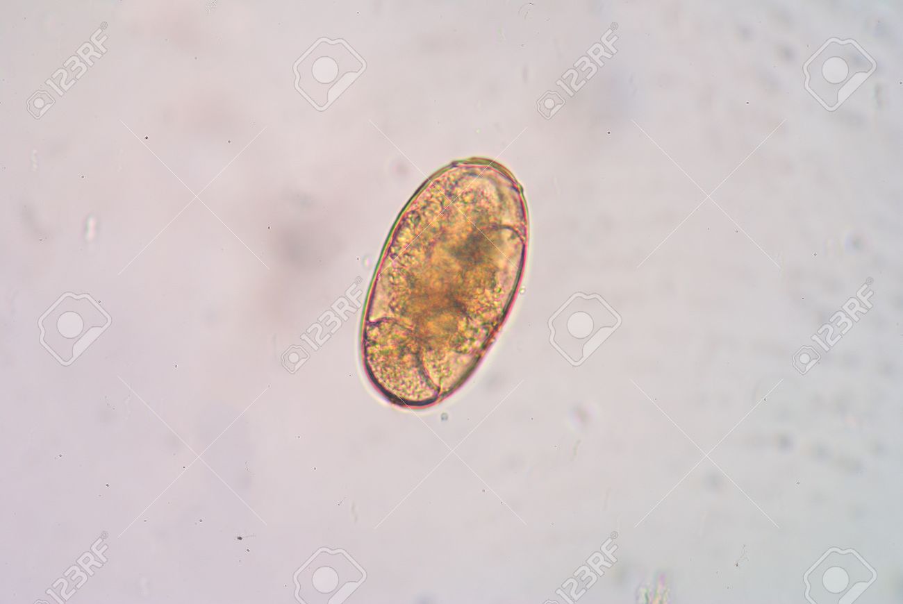 Paragonimus Westermani Is The Major Species Of Lung Fluke To Infects Humans Causing Paragonimiasis Stock Photo Picture And Royalty Free Image Image