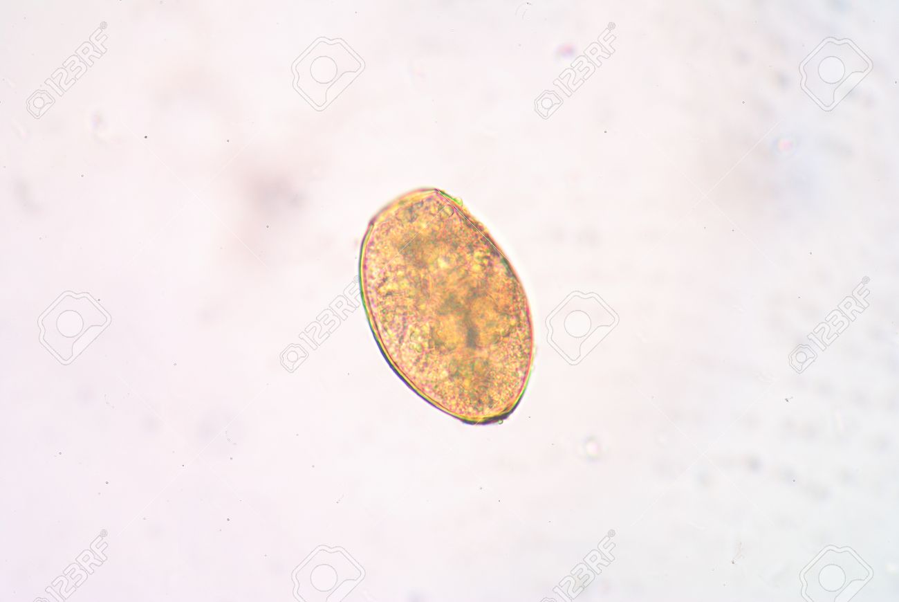 ウェステルマン 肺 吸虫 症状
