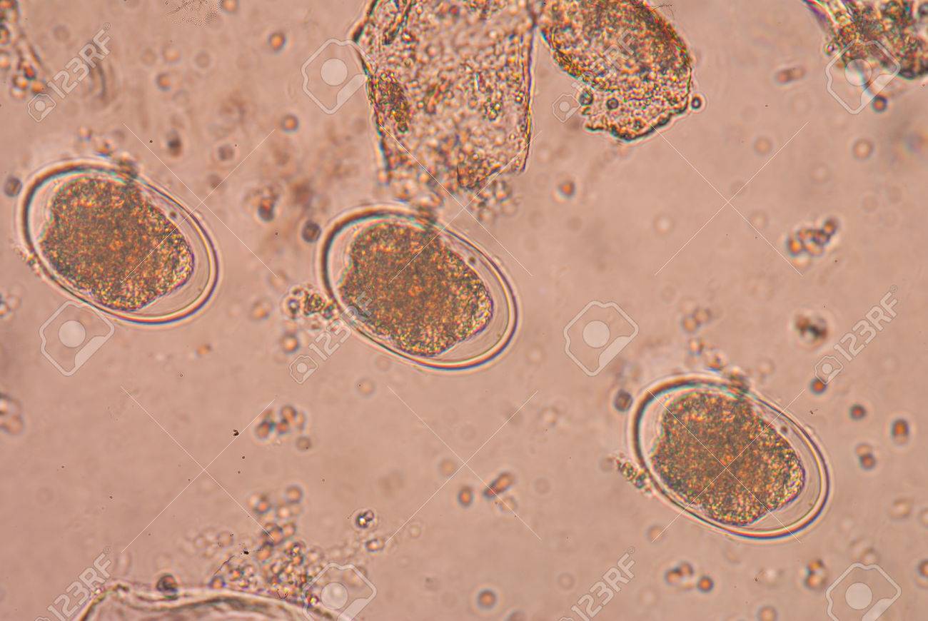 鉤虫、犬、猫、人間などの哺乳類は、そのホストの小腸に住んでいる寄生 