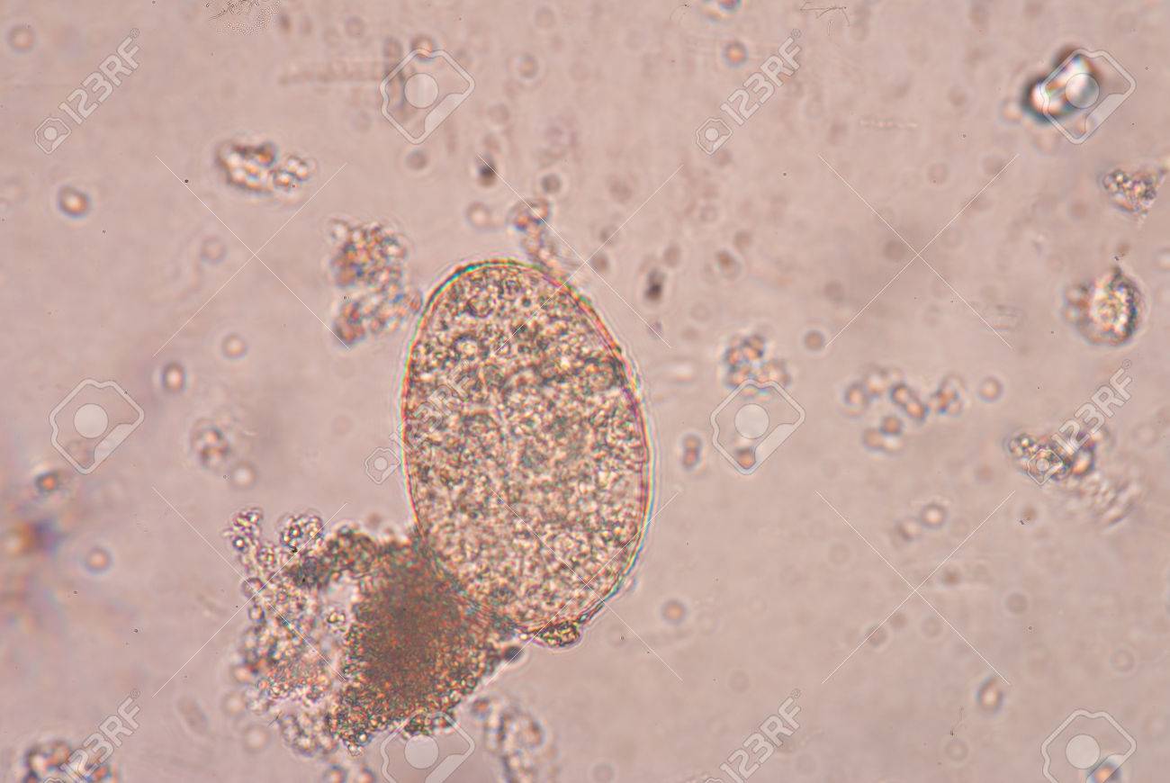 malattia del colpo di fortuna polmonare