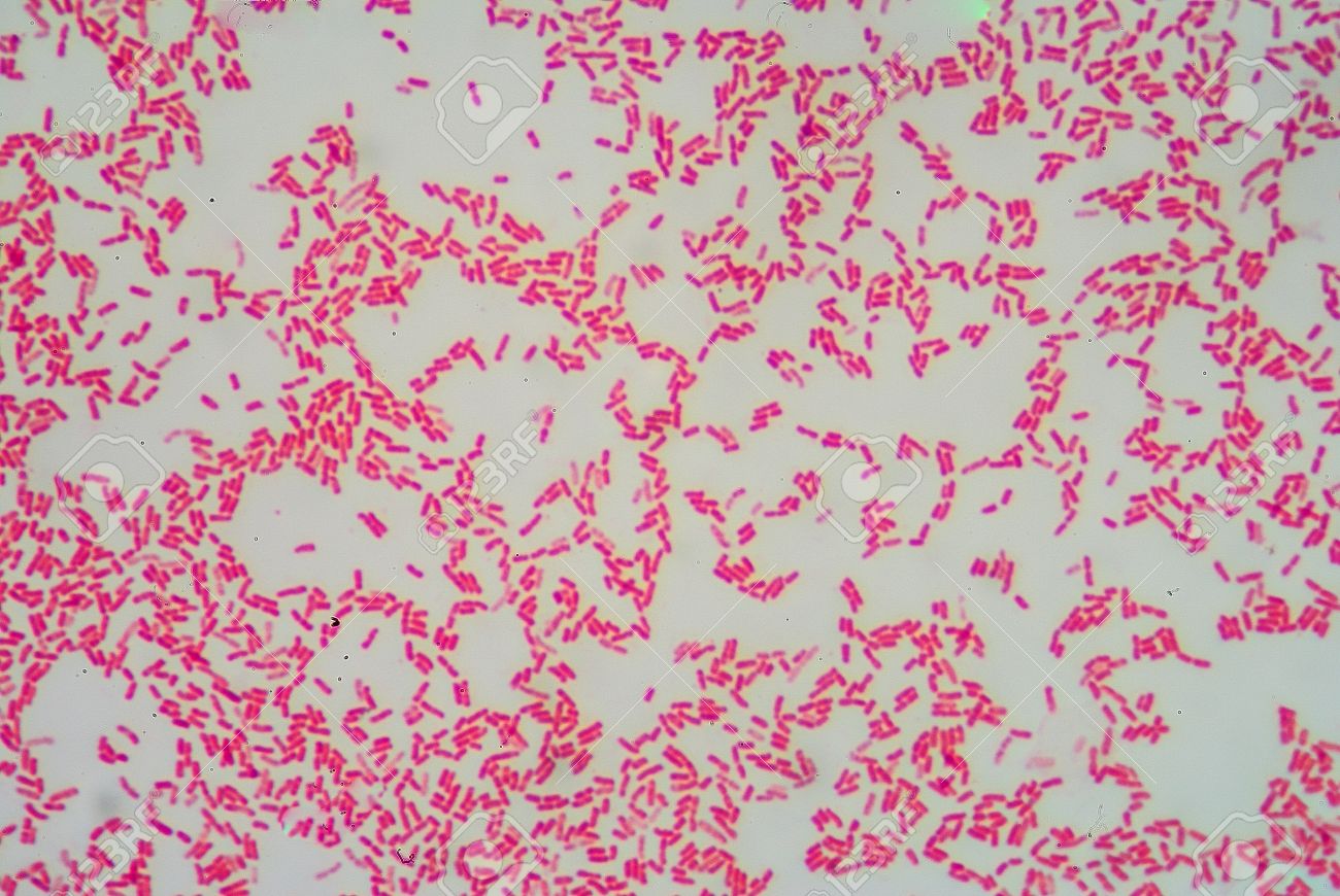 Фуксином окрашиваются бактерии. Фуксин пфейфера. Стафилококк окраска фуксином. Фуксином окрашиваются бактерии. Нейссерия гонорея окраска по граму.