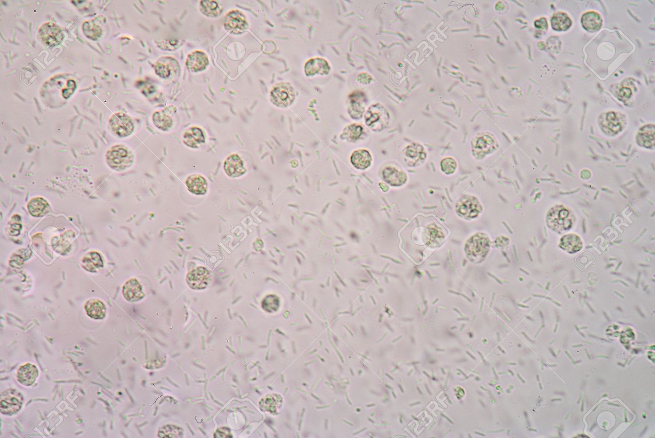 顕微鏡 400 倍下で尿検体中の細菌 の写真素材 画像素材 Image