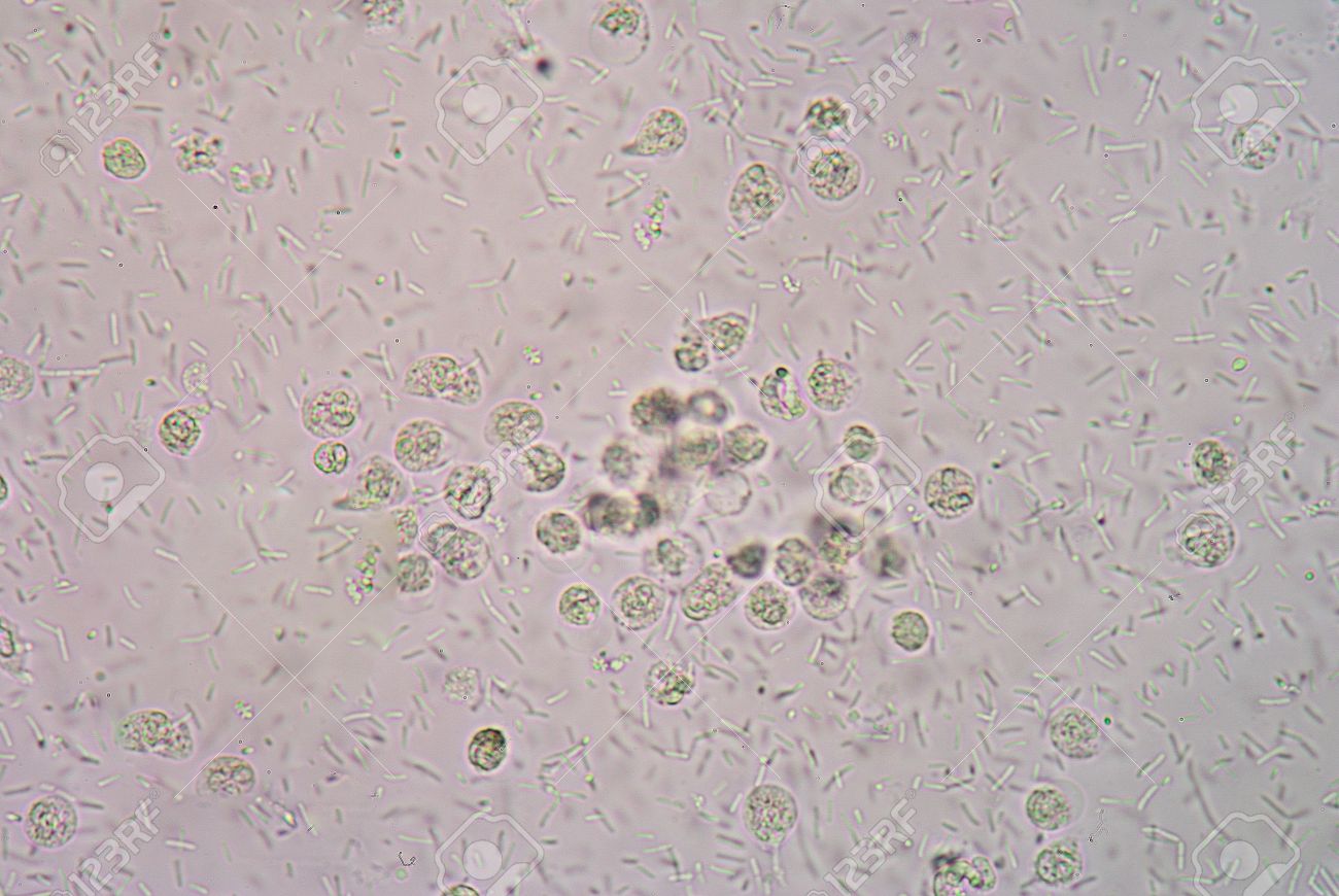 顕微鏡 400 倍下で尿検体中の細菌 の写真素材 画像素材 Image