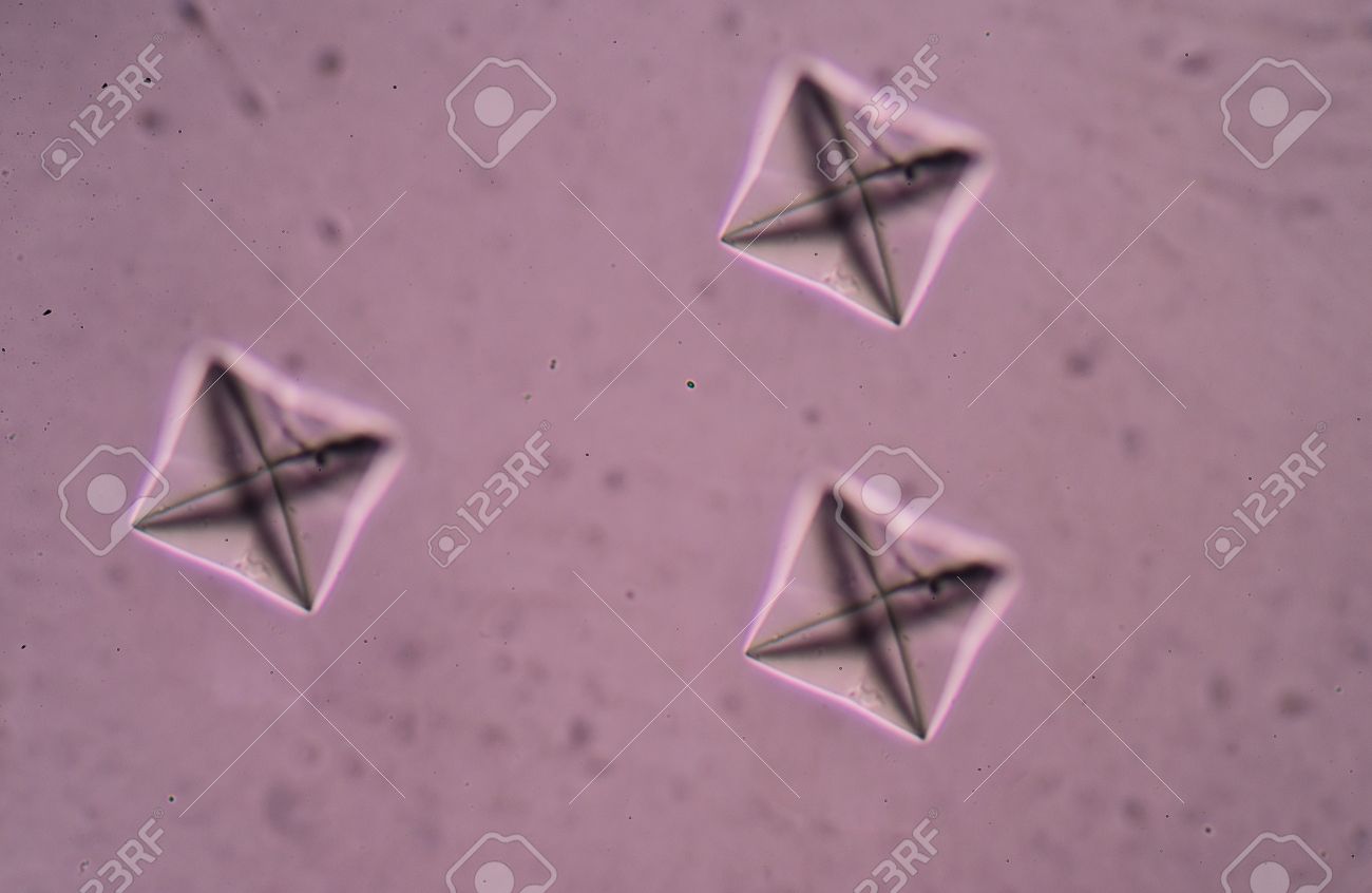 Cristales de oxalato