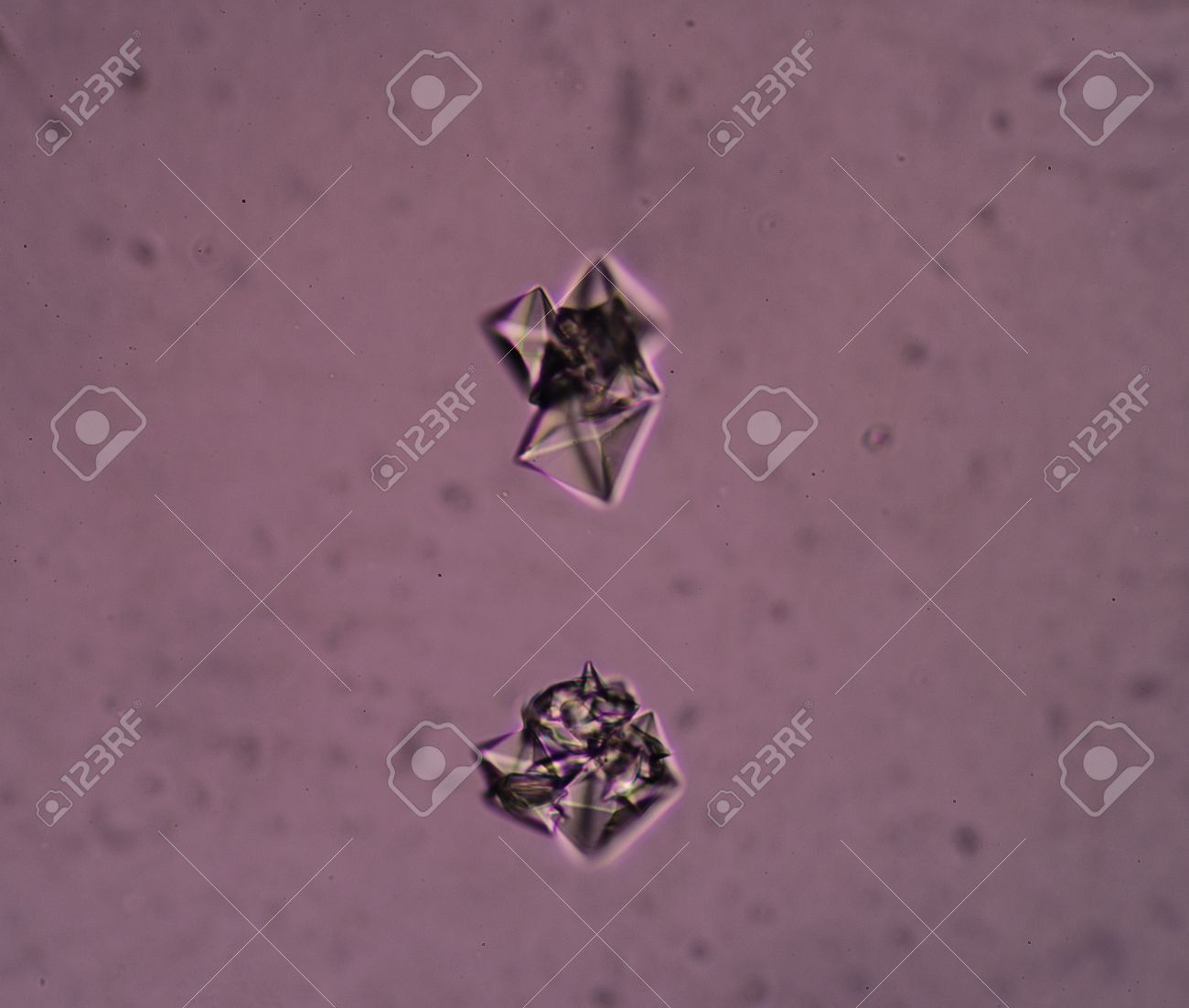 Cristales de oxalato