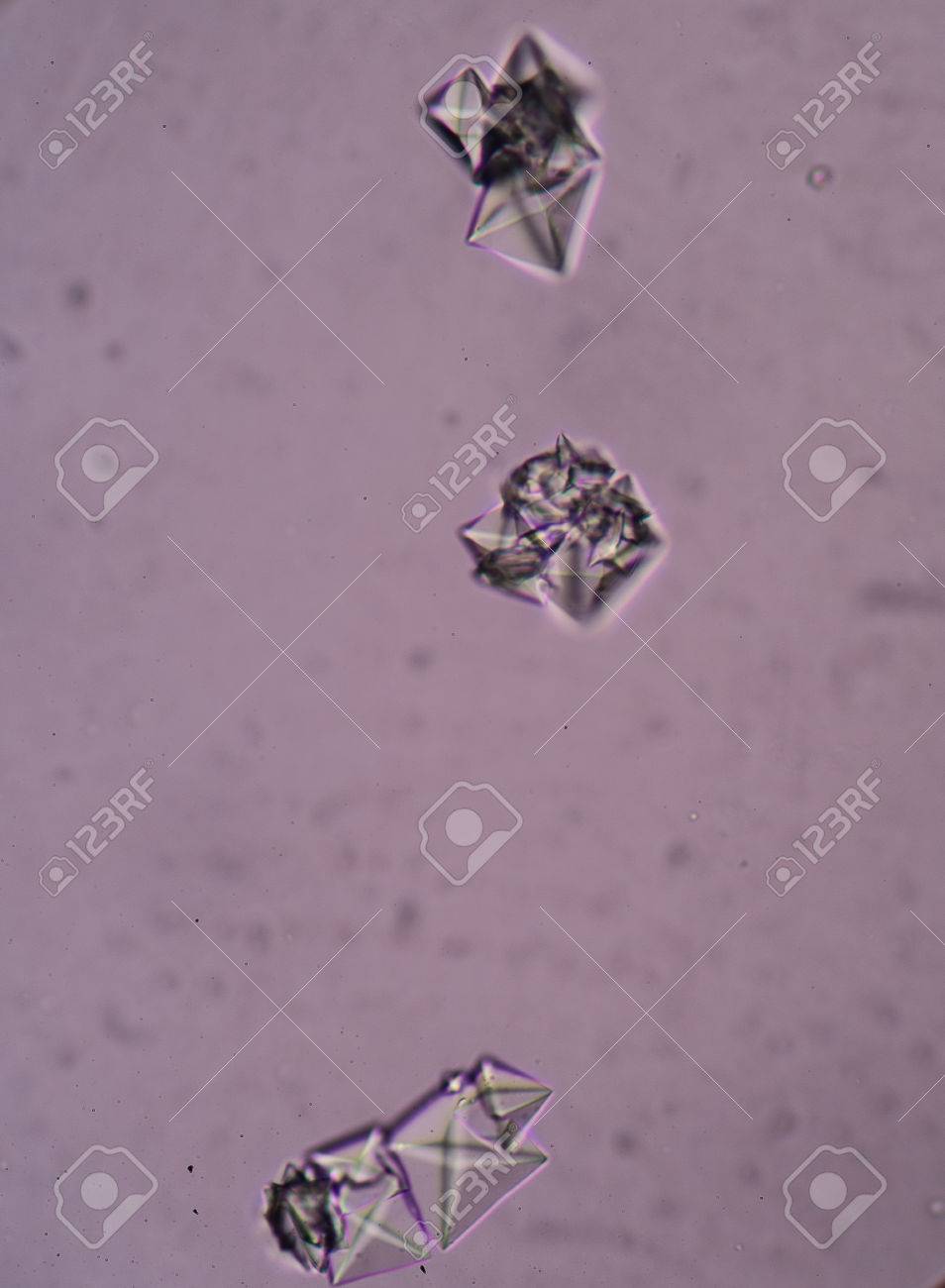 De oxalato cristales