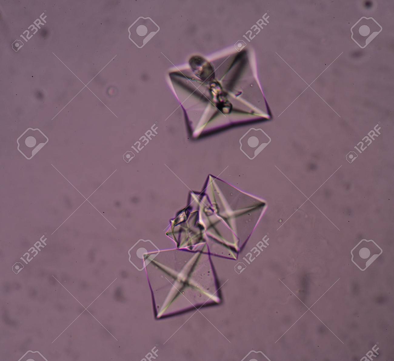 De oxalato cristales
