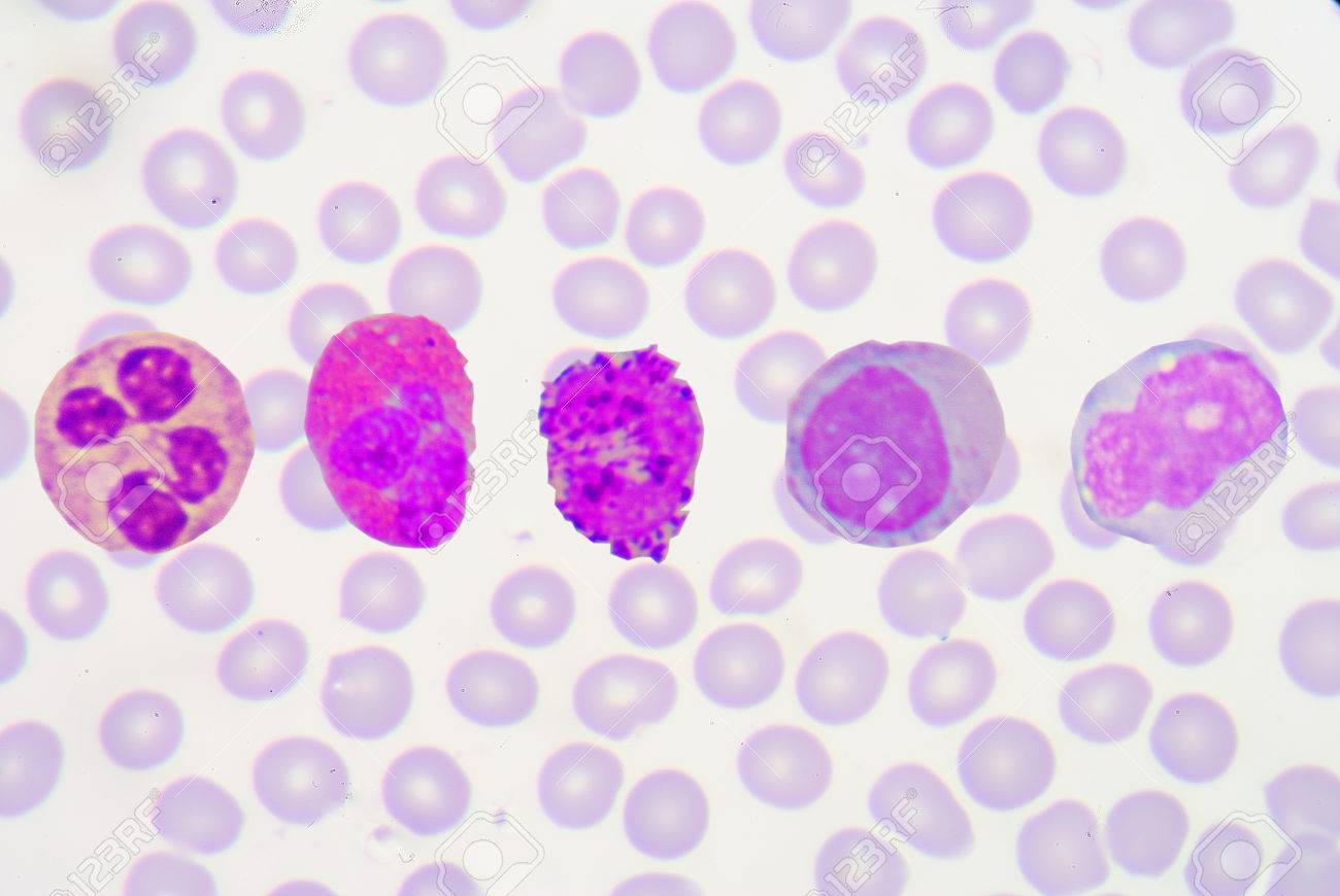 WBC is are composed of granulocytes (neutrophils, eosinophils, and basophils) and non-granulocytes (lymphocytes and monocytes). White blood cells are a major component of the body's immune system. - 42949032 WBC is are composed of granulocytes (neutrophils, eosinophils, and basophils) and non-granulocytes (lymphocytes and monocytes). White blood cells are a major component of the body's immune system. - 42949032