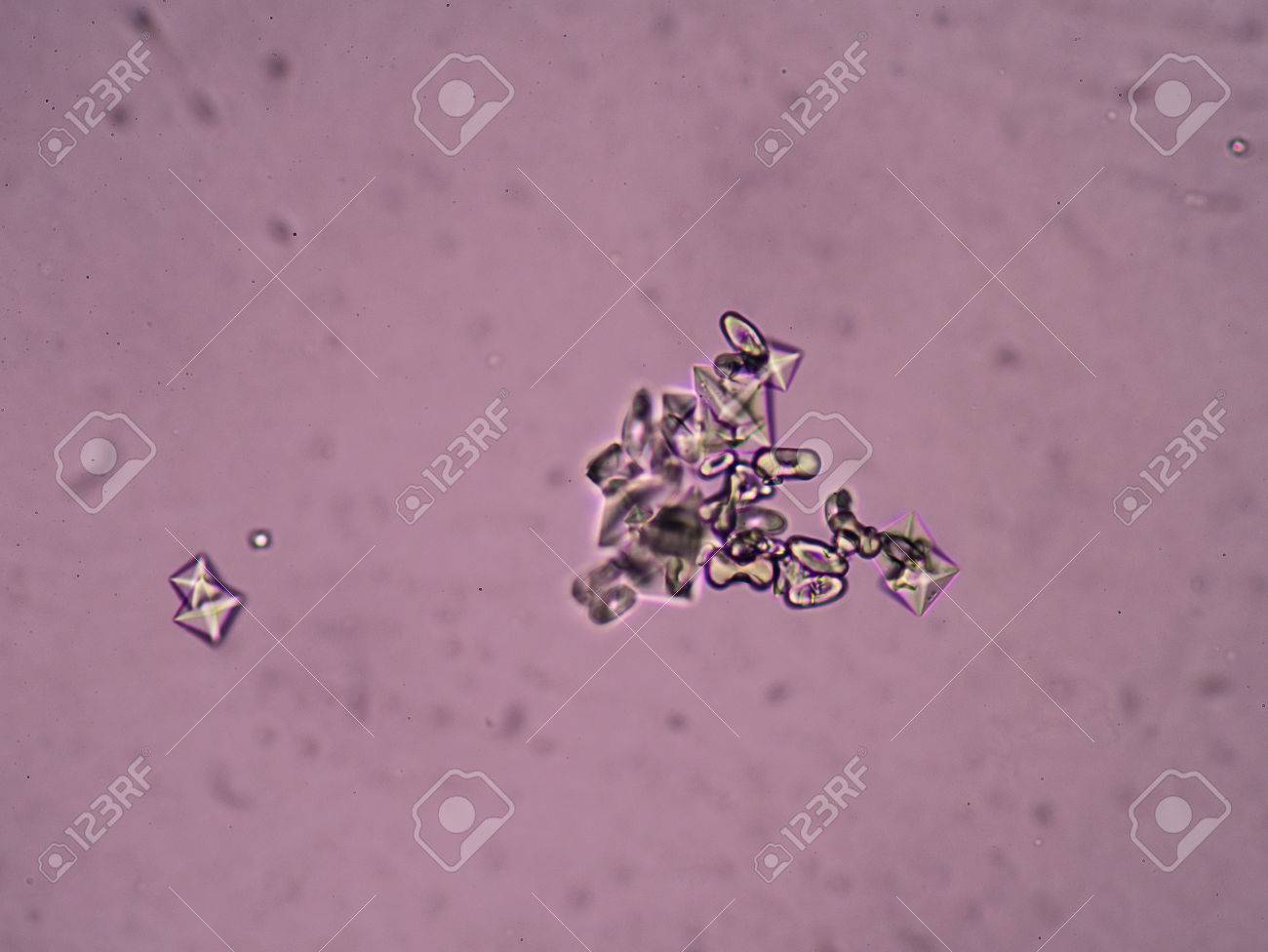 Cristales de oxalato